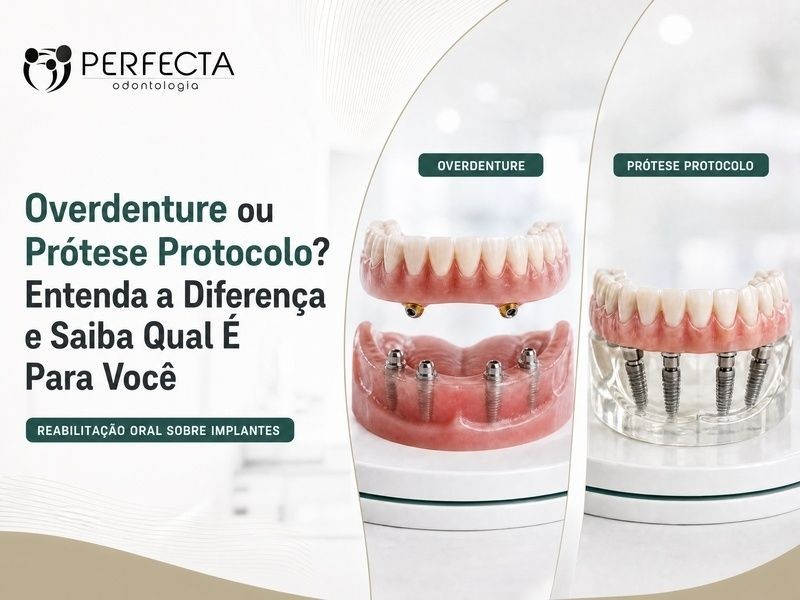 Overdenture ou Prótese Protocolo? Entenda a Diferença e Saiba Qual É Para Você