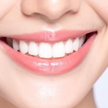 Planejamento Digital de Sorriso (DSD) em Conjunto Habitacional Padre Anchieta