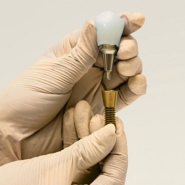 Implantodontia em Conjunto Habitacional Padre Anchieta