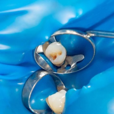 Selante Dental em Conjunto Habitacional Padre Anchieta