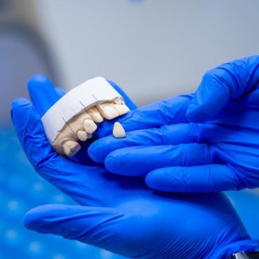 Prótese de Porcelana em Conjunto Habitacional Padre Anchieta