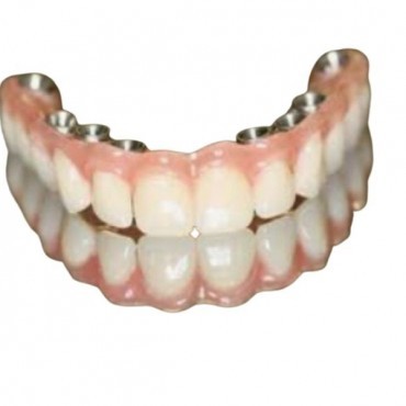 Prótese Protocolo em Conjunto Habitacional Padre Anchieta