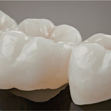 Coroas de Porcelana em Conjunto Habitacional Padre Anchieta