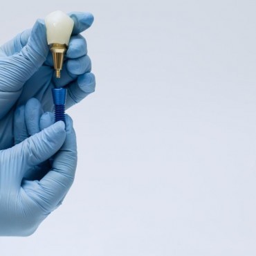 Prótese sobre Implante em Conjunto Habitacional Padre Anchieta