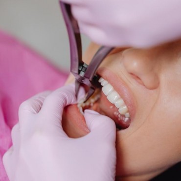 Extração Dental Complexa em Conjunto Habitacional Padre Anchieta