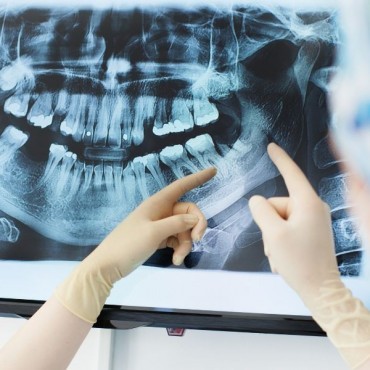 Raio-X Periapical em Conjunto Habitacional Padre Anchieta