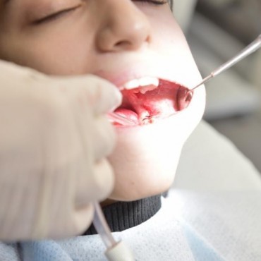 Cirurgia Periodontal em Conjunto Habitacional Padre Anchieta