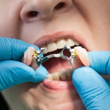 Prótese Dental Removível em Conjunto Habitacional Padre Anchieta