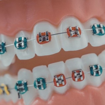 Aparelho Fixo em Conjunto Habitacional Padre Anchieta