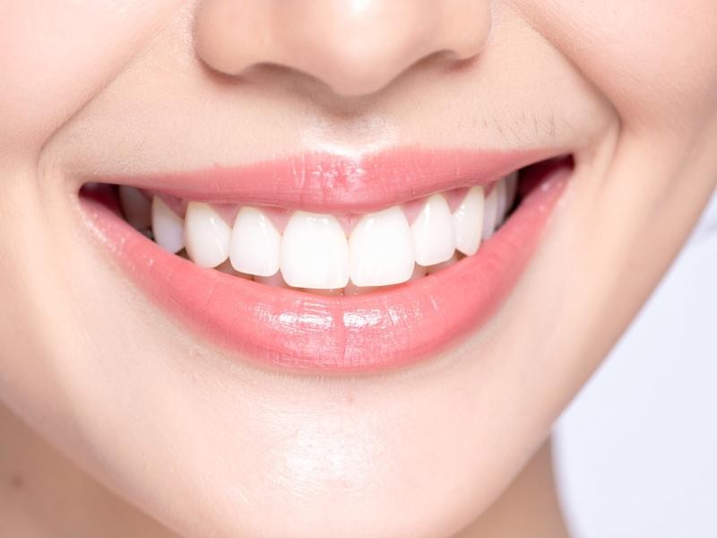 Planejamento Digital de Sorriso (DSD) em Conjunto Habitacional Padre Anchieta