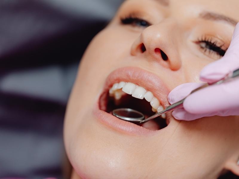 Reabilitação Oral Completa em Conjunto Habitacional Padre Anchieta