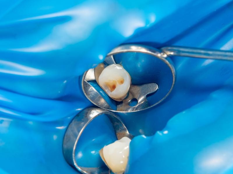 Selante Dental em Conjunto Habitacional Padre Anchieta