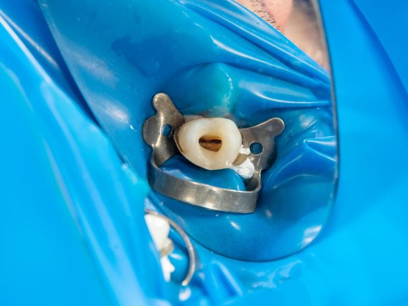 Retratamento de Canal em Conjunto Habitacional Padre Anchieta