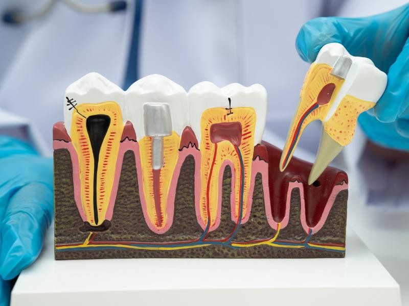 Tratamento de Canal em Conjunto Habitacional Padre Anchieta