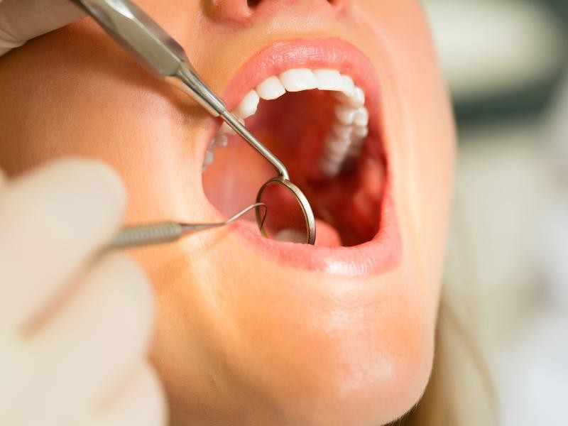 Tratamento de Erosão Dental em Conjunto Habitacional Padre Anchieta